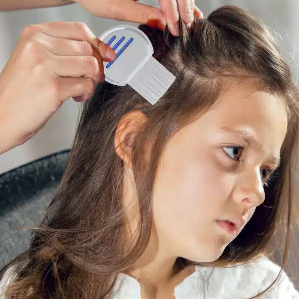 71r4z+Gi20L Lice and Nit Egg Free Treatment Professional Stainless Steel Lice Removal Comb - Hair Brush - Image 1