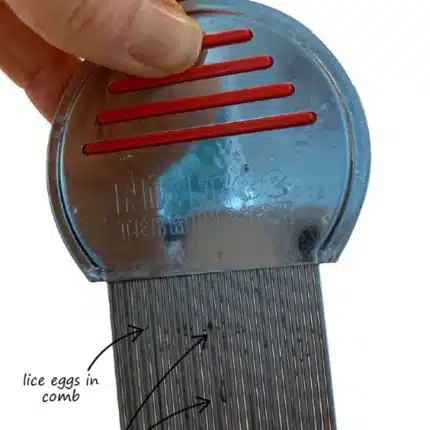 Lice and Nit Egg Free Treatment Professional Stainless Steel Lice Removal Comb - Hair Brush - Image 3